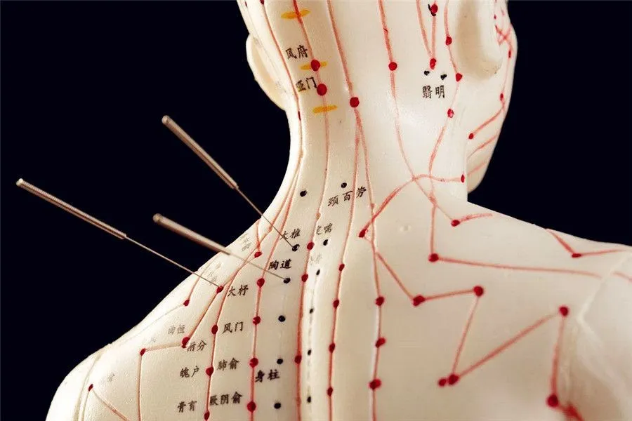 The Meridian System and Acupuncture