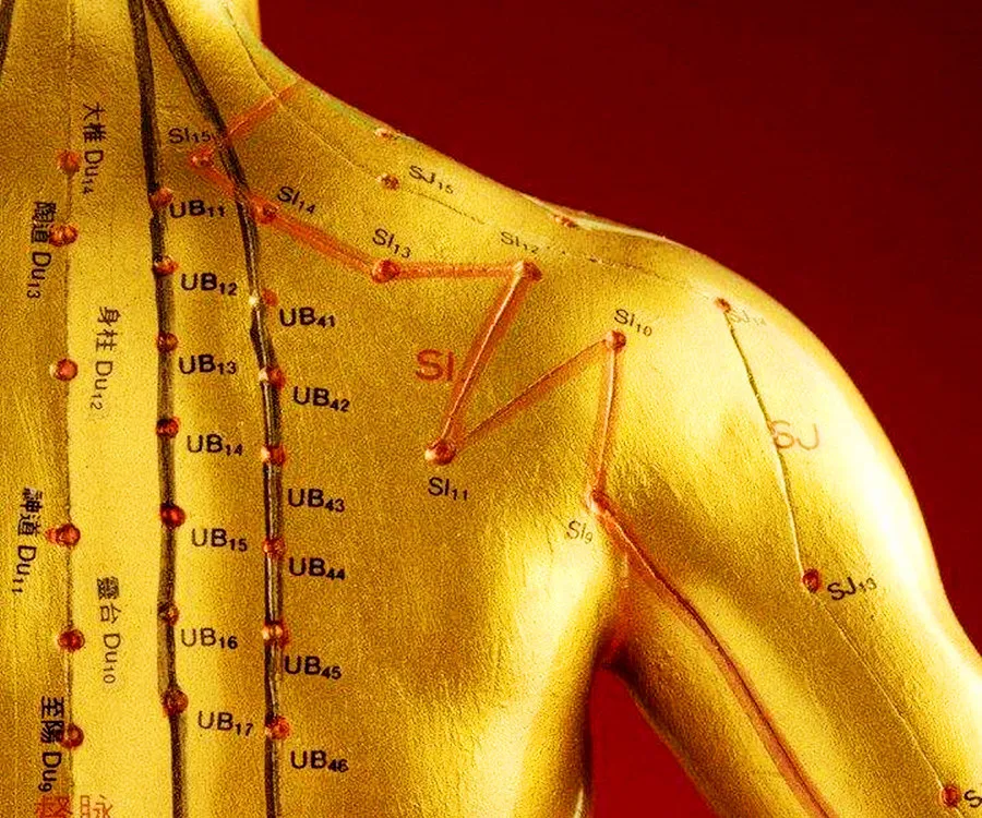 Chinese Acupuncture and Moxibustion - Bronze Acupuncture Status