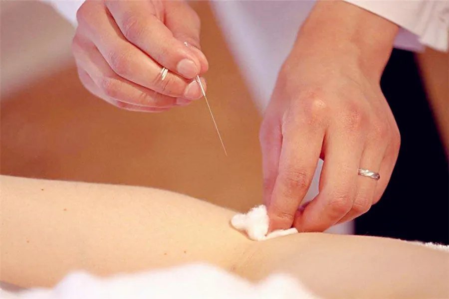 Chinese Acupuncture and Moxibustion - how to created