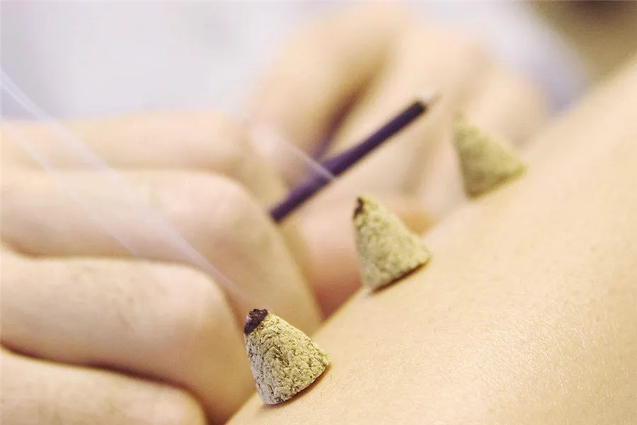 Chinese Acupuncture and Moxibustion -Origin of moxibustion 